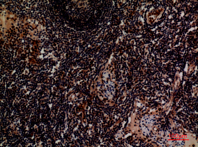 Integrin alpha 4 Rabbit pAb ABZ1506