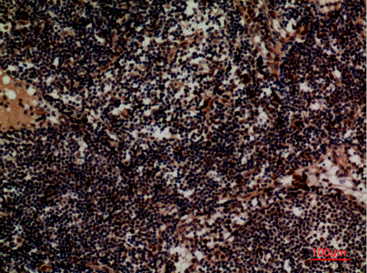 Integrin alpha 4 Rabbit pAb ABZ1506