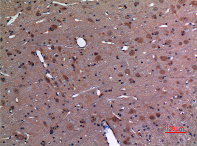 Ubiquitin Conjugating Enzyme E2 A/B Rabbit pAb ABZ1514