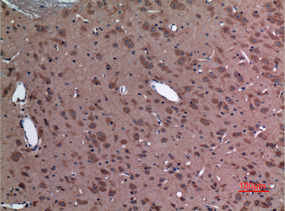 Ubiquitin Conjugating Enzyme E2 A/B Rabbit pAb ABZ1514
