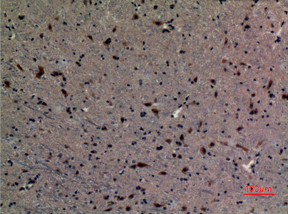 Ubiquitin Conjugating Enzyme E2 A/B Rabbit pAb ABZ1514