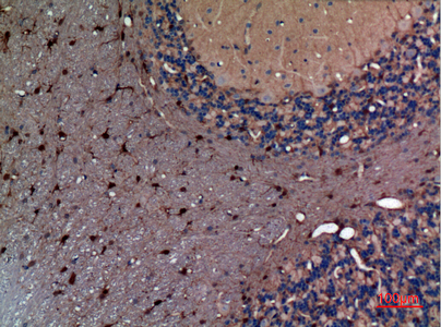 alpha 1 Fetoprotein Rabbit pAb ABZ1515