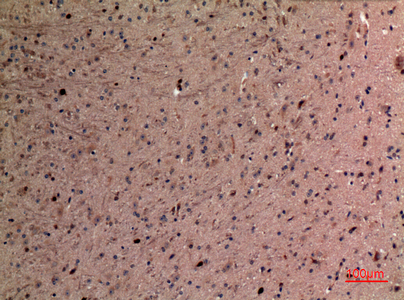 alpha 1 Fetoprotein Rabbit pAb ABZ1515