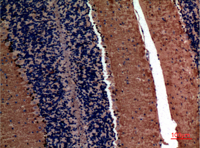 alpha 1 Fetoprotein Rabbit pAb ABZ1515