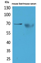 alpha 1 Fetoprotein Rabbit pAb ABZ1515