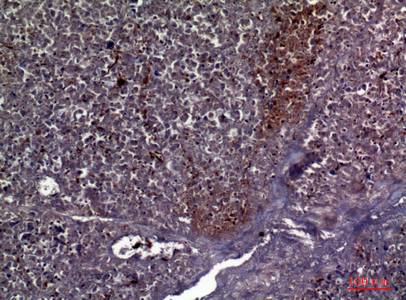 Collagen V alpha 2 Rabbit pAb ABZ1526