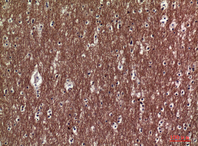 Collagen V alpha 2 Rabbit pAb ABZ1526