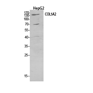 Collagen V alpha 2 Rabbit pAb ABZ1526