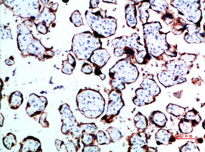 Growth Hormone Rabbit pAb ABZ1532