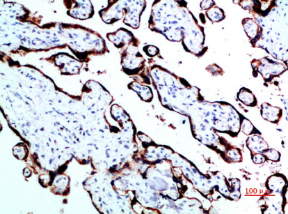 Growth Hormone Rabbit pAb ABZ1532