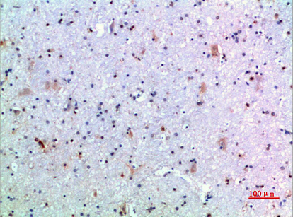 Growth Hormone Rabbit pAb ABZ1532