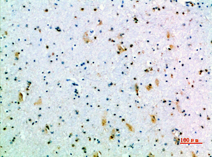 Growth Hormone Rabbit pAb ABZ1532