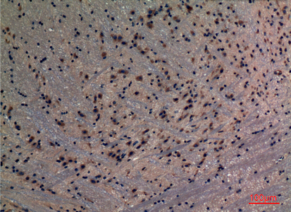 PREP Rabbit pAb ABZ1535