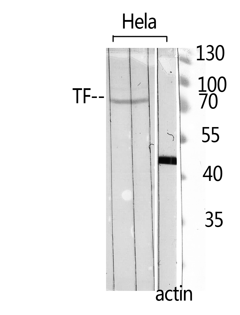Transferrin Rabbit pAb ABZ1540