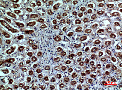 Neuropilin 1 Rabbit pAb ABZ1543