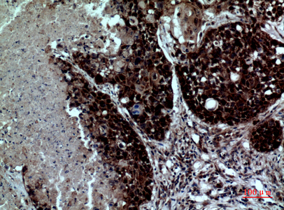 Integrin alpha 4 Rabbit pAb ABZ1544