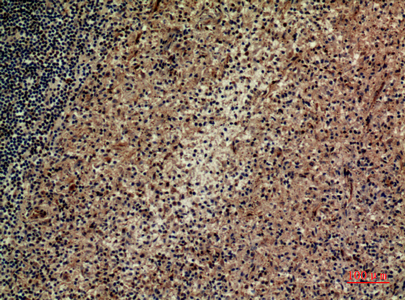 Integrin alpha 4 Rabbit pAb ABZ1544