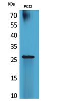 RNA Polymerase III Subunit C7 Rabbit pAb ABZ1546