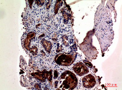 Prostate Specific Antigen Rabbit pAb ABZ1549