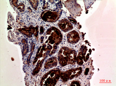 Prostate Specific Antigen Rabbit pAb ABZ1549
