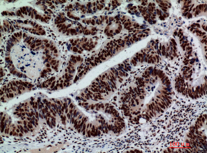 GLB1/Beta-galactosidase Rabbit pAb ABZ1551