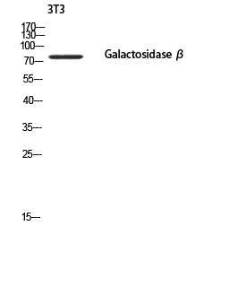 GLB1/Beta-galactosidase Rabbit pAb ABZ1551