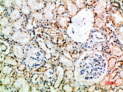 CD16 Rabbit pAb ABZ1554