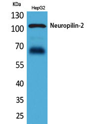 Neuropilin 2 Rabbit pAb ABZ1565