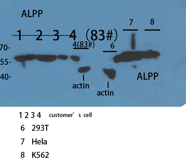 Placental Alkaline Phosphatase Rabbit pAb ABZ1569