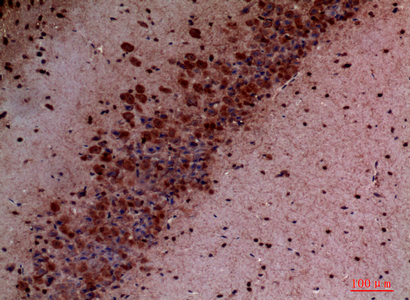PI3 Kinase p110 delta Rabbit pAb ABZ1572