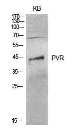 Poliovirus Receptor/PVR Rabbit pAb ABZ1580