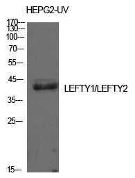 LEFTY Rabbit pAb ABZ1582
