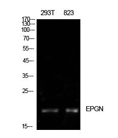 Epigen Rabbit pAb ABZ1583