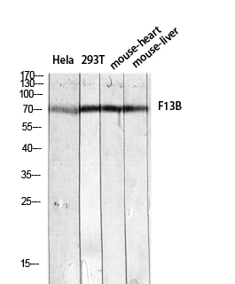 Factor XIII Rabbit pAb ABZ1586