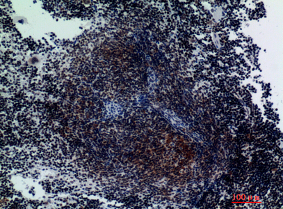Integrin alpha 3 Rabbit pAb ABZ1587