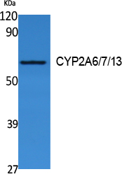Cytochrome P450 2A6/7/13 Rabbit pAb ABZ1604