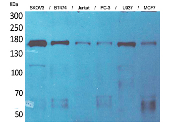 Synaptonemal Complex Protein 2 Rabbit pAb ABZ1610