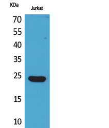 Interferon epsilon Rabbit pAb ABZ1616