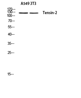 Tensin 2 Rabbit pAb ABZ1628