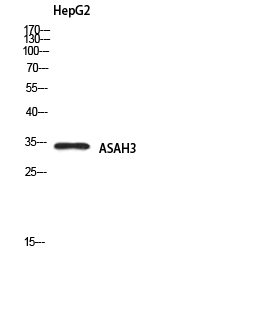ASAH3 Rabbit pAb ABZ1629