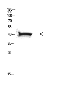 HLA A Rabbit pAb ABZ1640