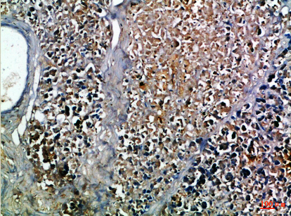 Insulin Rabbit pAb ABZ1648