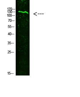 Collagen XIX alpha 1 Rabbit pAb ABZ1653