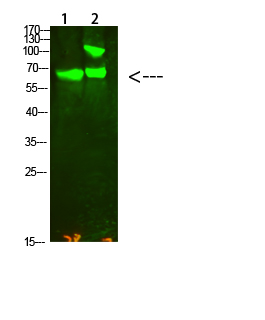 Collagen XIII alpha 1 Rabbit pAb ABZ1658