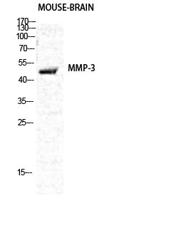 MMP3 Rabbit pAb ABZ1677
