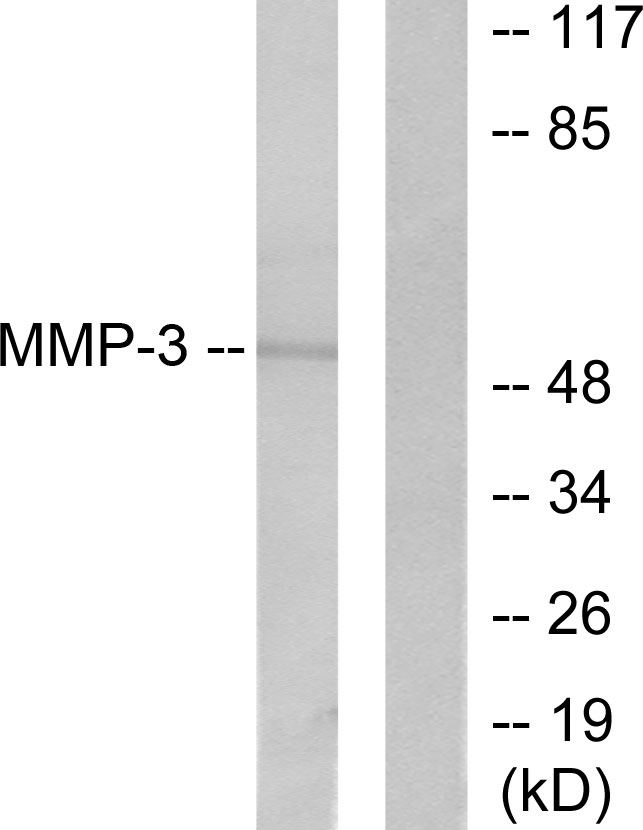 MMP3 Rabbit pAb ABZ1677