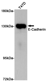 E Cadherin Rabbit pAb ABZ1688