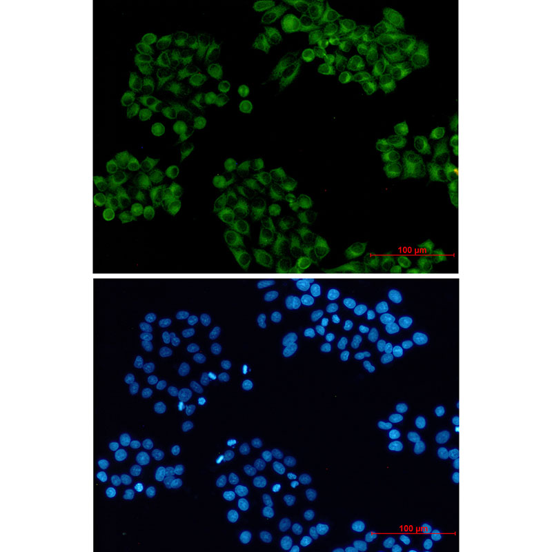 Cellubrevin Rabbit mAb ABZ1706