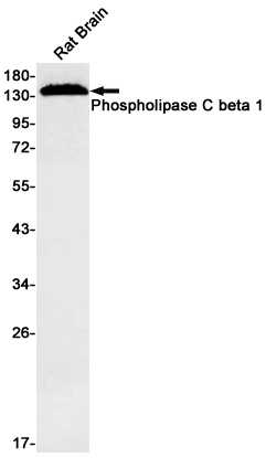 Phospholipase C beta 1/PLCB1 Rabbit mAb ABZ1707