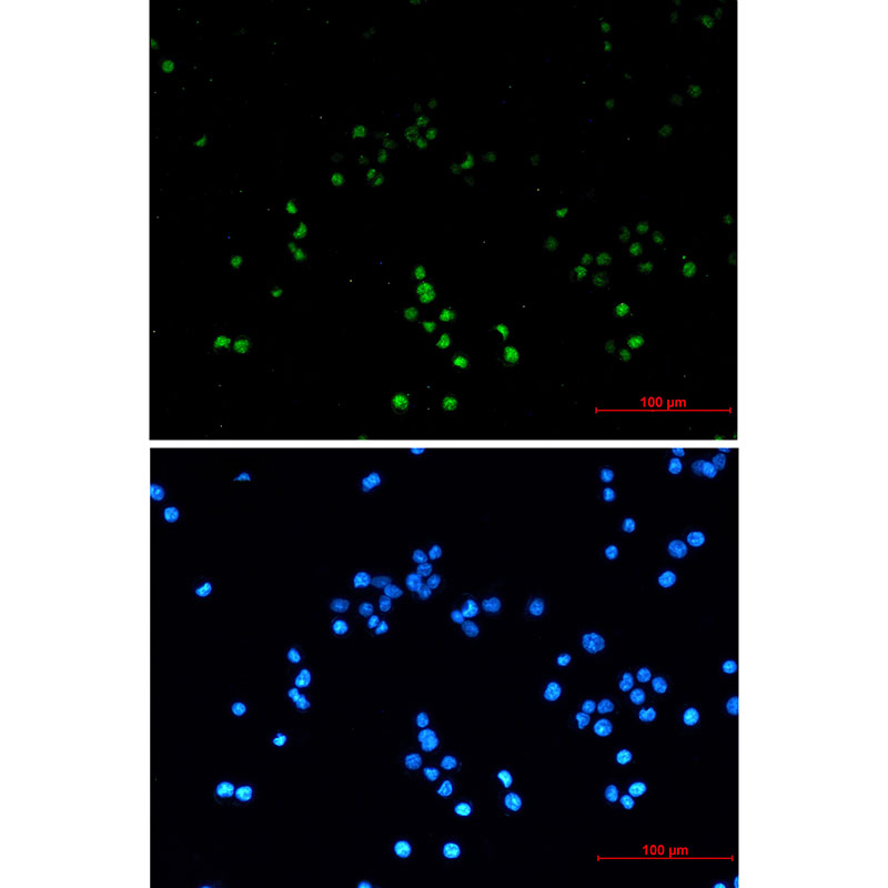 ZHX2 Rabbit mAb ABZ1708